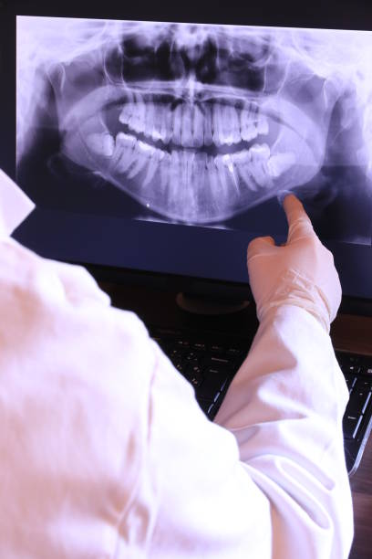 Best Emergency Dentist for Knocked-Out Tooth in Orange, CA