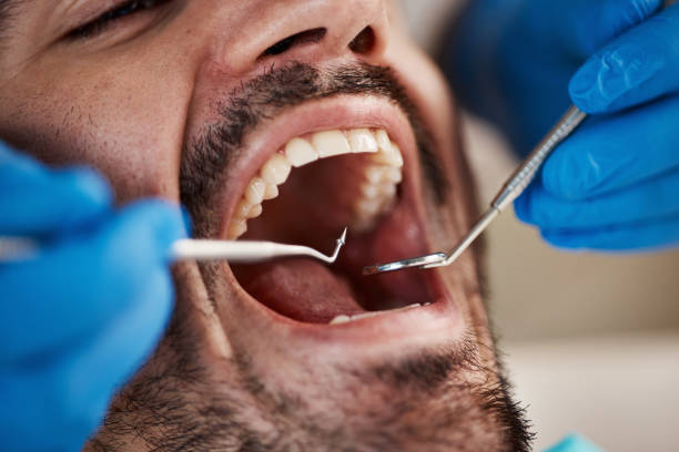 Best Pediatric Emergency Dentist in Orange, CA